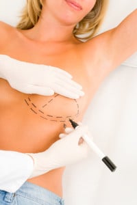 marin county breast lift consultation